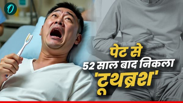 Bizarre News: 12 की उम्र में निगला था 'टूथब्रश’, डॉक्टर्स ने 52 साल बाद पेट से निकाला, आंत के पास चिपका रहा