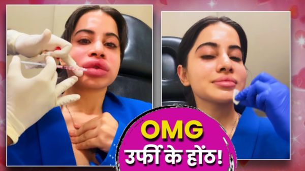 Urfi Javed ने 9 साल बाद हटवाए लिप फिलर क्यों? लबों पर इंजेक्शन, सूज गया पूरा चेहरा-दर्दनाक VIDEO