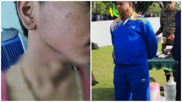 Bhopal News: जवाहरलाल नेहरू सीनियर सेकेंडरी स्कूल में शर्मनाक घटना, PT टीचर ने छात्र को बेरहमी से पीटा