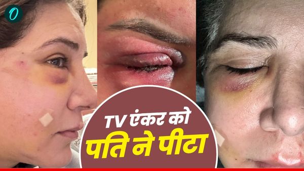 Domestic Violence: महिला टीवी एंकर को पति ने इतना पीटा कि चेहरा सुजा दिया, घरेलू हिंसा पर बहस तेज