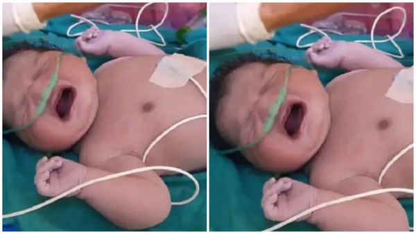 MP News Indore: मध्य प्रदेश में जन्मा अब तक का सबसे वजनी बच्चा, बच्ची का वजन 5.43 किलो, डॉक्टर भी रह गए हैरान