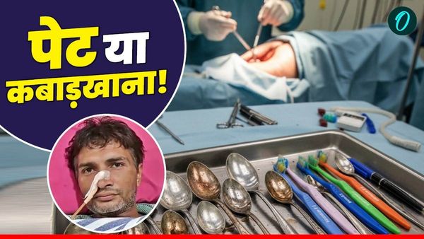 शख्‍स के पेट से निकला 29 चम्मच, 19 ब्रश और 2 पेन, ऑपरेशन करते ही डॉक्टर भी हो गए दंग