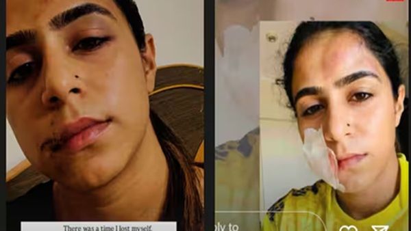 'पेट पर लात मारी, चेहरा बिगाड़ दिया', फेमस टीवी एक्ट्रेस का दर्दनाक ट्रॉमा, Ex- बॉयफ्रेंड ने की ऐसी हालत