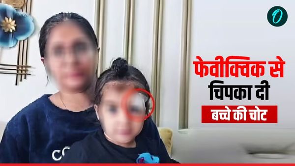 UP News: डॉक्‍टरों ने फेवीक्विक से चिपका दी बच्‍चे की चोट, दर्द से कराहता रहा मासूम और फिर? 