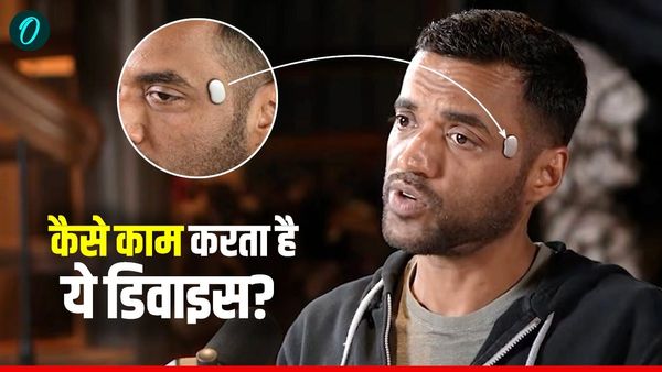 Zomato CEO Deepinder Goyal की कनपटी पर लगा 'Temple' चिप क्या है? कीमत कितनी? कैसे करता है काम?