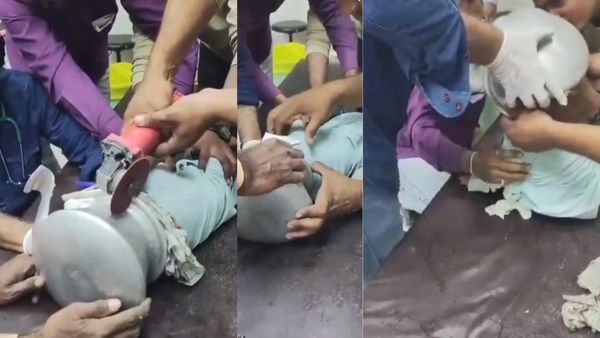 Jalgaon Child Rescue Video: बर्तन में फंसी बच्चे की गर्दन, फिर डॉक्टर ने किया कुछ ऐसा कि सब दंग रह गए