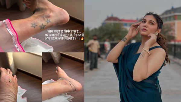 'सूजे पैर, मोटे छाले, दर्द में हूं', ये क्या हुआ डांसर सपना चौधरी के साथ? होली इवेंट पर किसने किया ऐसा हाल?
