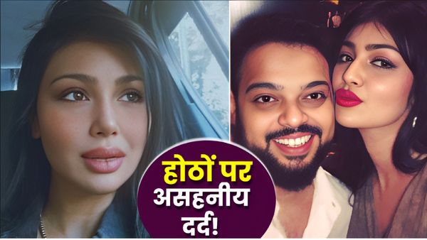 Ayesha Takia ने मुस्लिम से निकाह के बाद होठों पर सहा इतना दर्द, बदल गई सूरत, तस्वीरों ने खोला राज!