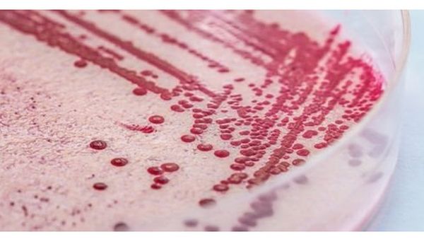 ऑस्ट्रेलिया: ख़रबूज़ा खाने से तीन मरे, लेकिन कैसे