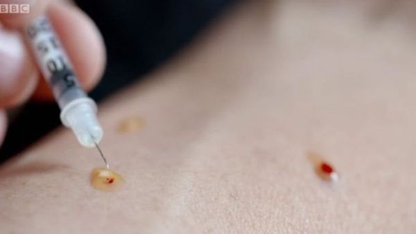 अब भारत में इच्छामत्यु के लिए वसीयत लिख पाएंगे लोग
