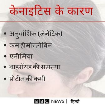 कम उम्र में बाल सफ़ेद क्यों हो रहे हैं?