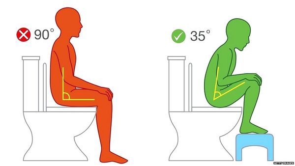 कहीं आप टॉयलेट में ख़तरनाक ढंग से तो नहीं बैठ रहे हैं?