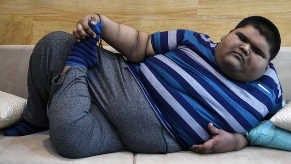 भारत में बच्चों में मोटापा बन सकता है महामारी