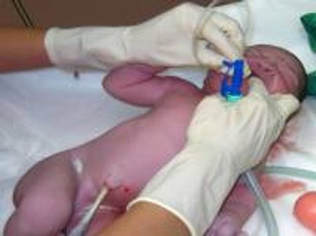 One woman dies every 7 min during childbirth in India