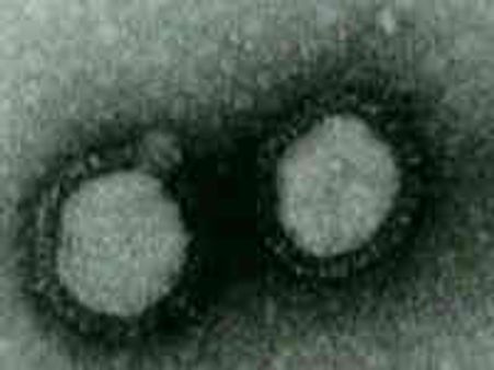 Oz confirms 2 more cases of Swine Flu