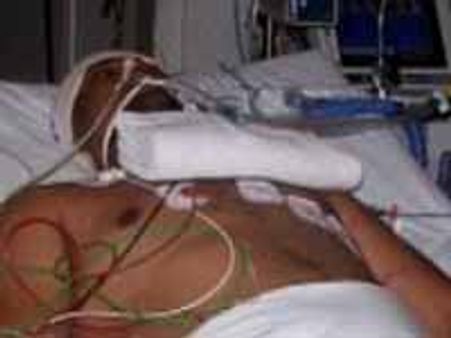 Oz Racial attack: AP student battling for life