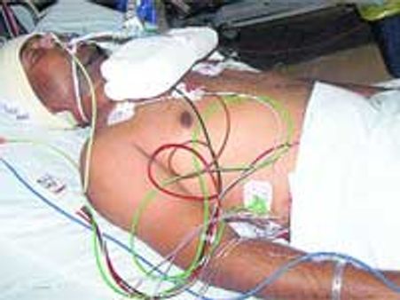Racial attacks: Injured Shravan 'out of danger'