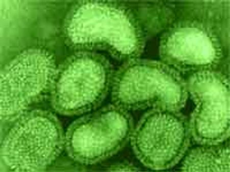 Cipla releases new Swine Flu drug