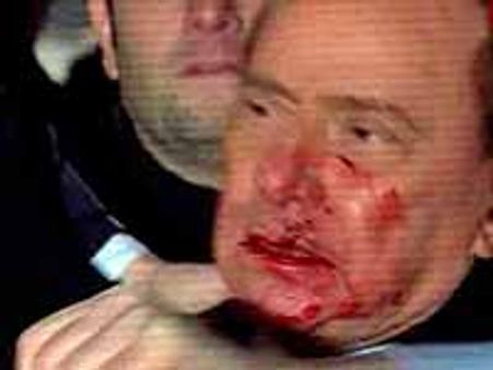 Italy PM Berlusconi hit in the face, left bleeding