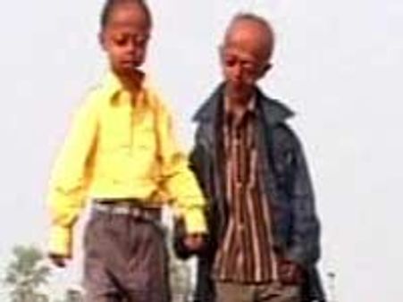 Bihar progeria victim dies before meeting Big B