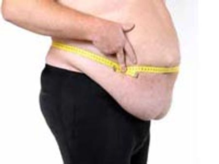 Developing nations facing 'obesity epidemic'