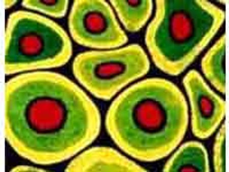 Rare disease 'paves way for creating stem cells'