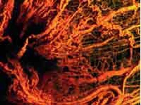 Study: Tumours make their own blood vessels