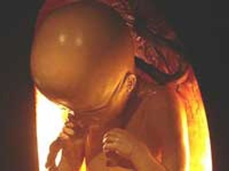 Chemical in toothpastes 'can leave unborn babies brain damaged'