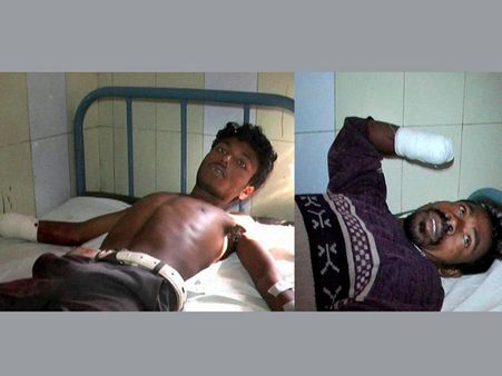 Labourers hands chopped: SC notice to Odisha, Andhra Pradesh