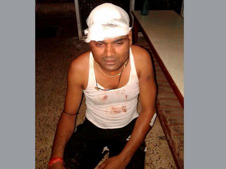 Bhilai steel plant gas leakage: Magisterial probe ordered