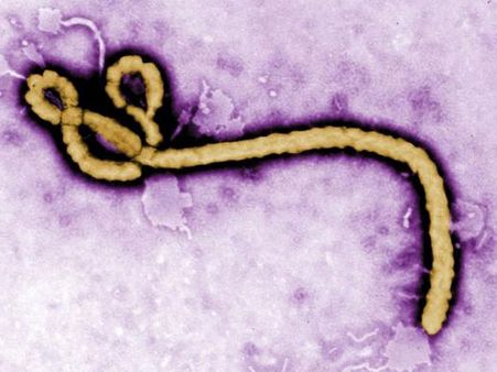 One suspected Ebola case reported in Benin