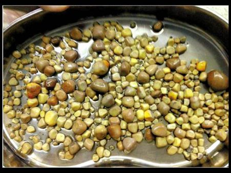 Side-effects of eating excessive Tofu: Doctors remove 420 kidney stones from a patient