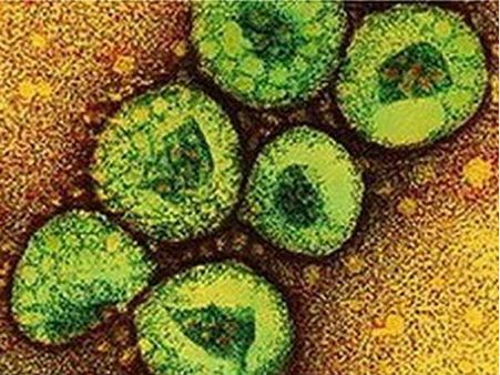 New MERS vaccine fully protects monkeys