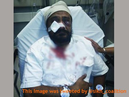 Elderly Sikh-American brutally assaulted in US