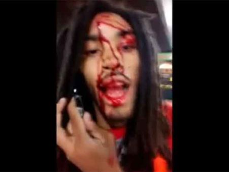 Selfie shocker: This California-based Rapper gets shot in the head, uploads video on Facebook