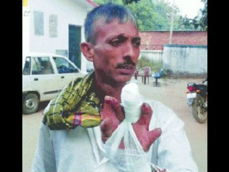 Bizarre: Man chops off his finger to celebrate Nitish Kumar's victory!