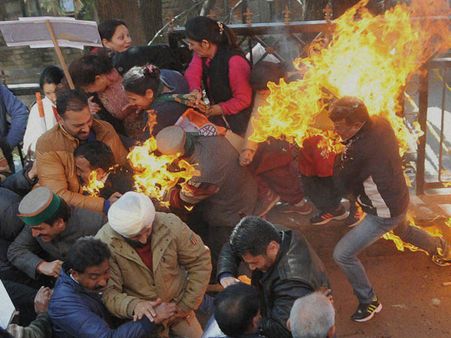 Himachal Congress activists injured while burning PM Modi's effigy, video goes viral