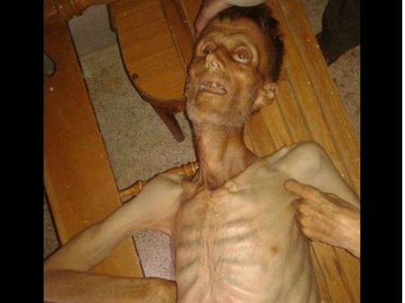 Syrian crisis: People survive on cats and grass, says Report