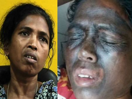 Top cop behind the attack on tribal activist Soni Sori?