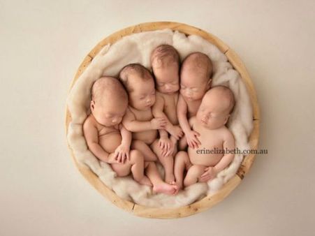 50 fingers 50 toes, 6 hearts beating at once: This is how woman described her quintuplet pregnancy
