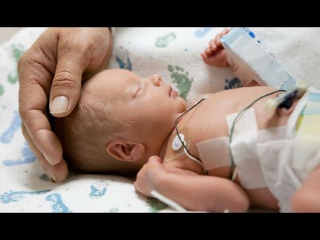Within six hours of birth, baby undergoes heart valve repair
