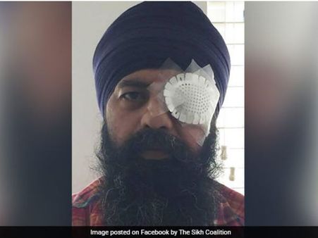 Racial attack in US: Sikh techie faces brutal assault, civil rights group demands justice