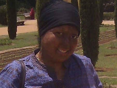 From acid attack survivor to crusader, Pragya Singh's inspiring journey