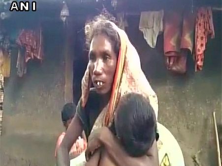 Jharkhand 'starvation' death: Did the girl die of malaria?