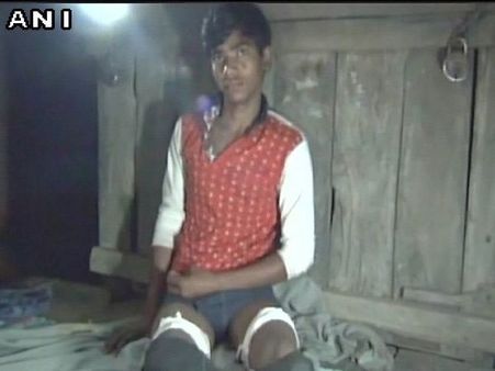 School boy suffers bruises as his jeans get cut off as punishment