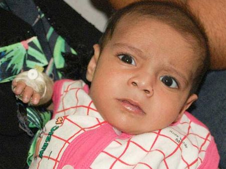 Born with a weak heart, Abu needs two more surgeries to live