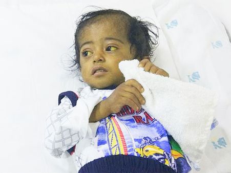 Ankur Cannot Afford His Son’s Heart Surgery on a Daily Wage Income