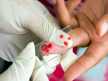 Goa villages to get handheld blood testing devices
