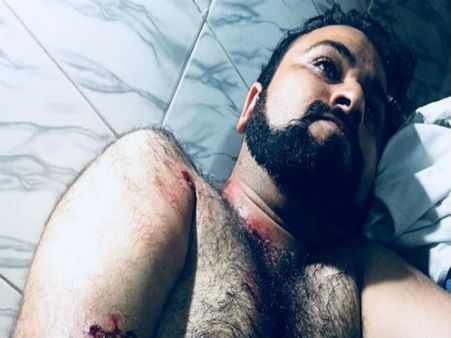 Dr Kafeel Khan's brother shot at in UP’s Gorakhpur, condition critical