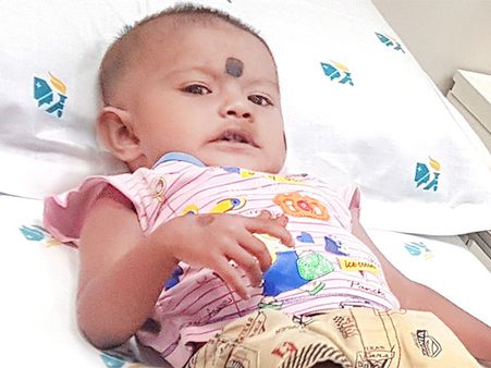 Little Kanisri’s Weak Heart Defect Makes Her Turn Blue From Pain